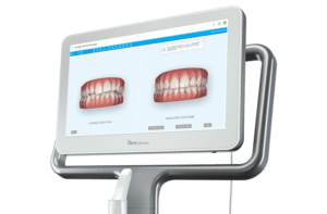 iTero Scanner Gather Orthodontics in Holly Springs, NC